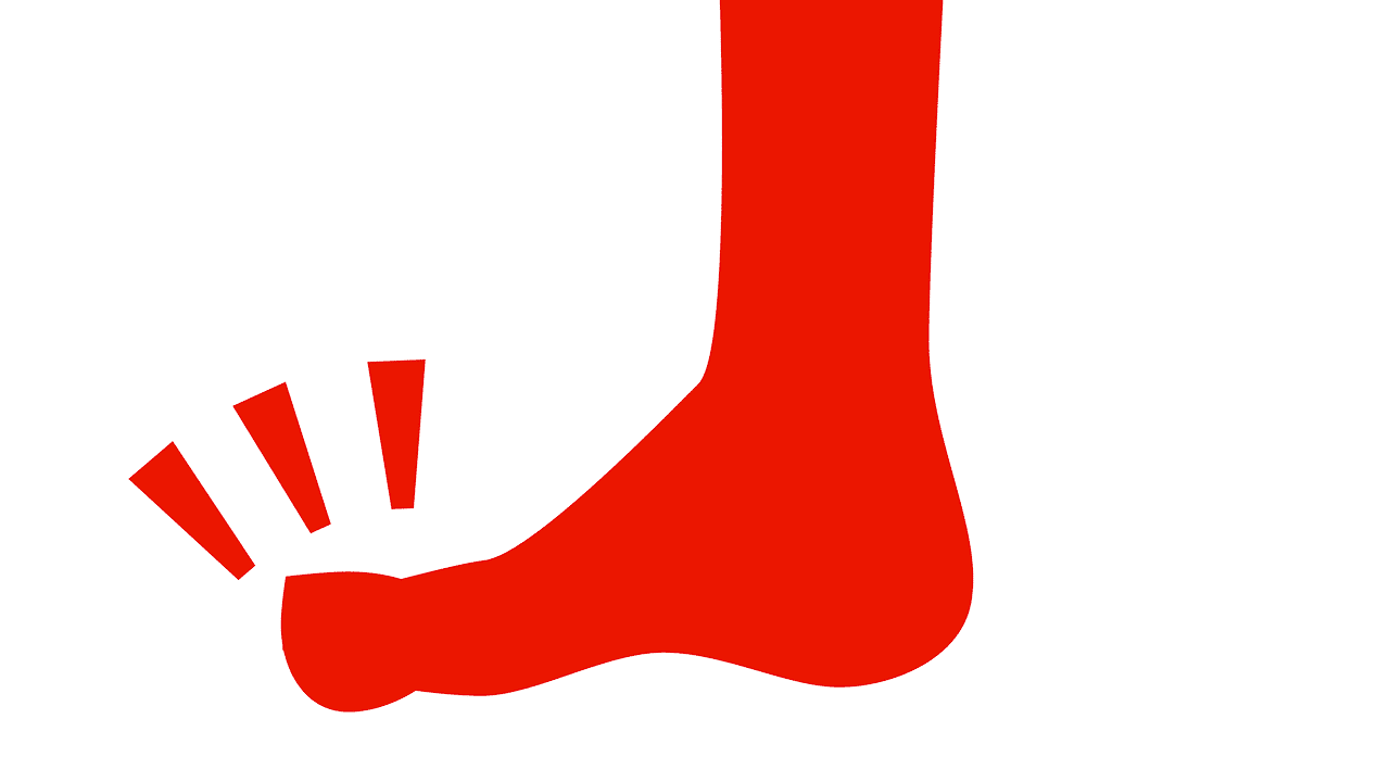 gelenkschwellung-eines-fingers-einer-zehe Symbolische Darstellung eines geschwollenen Zehs als typisches Symptom einer Psoriasis-Arthritis