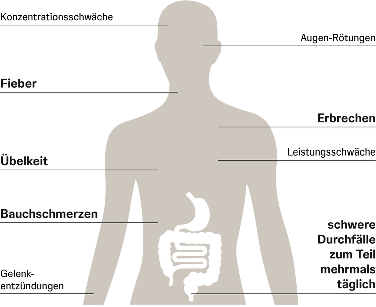 Schaubild mögliche Symptome bei Morbus Crohn & Colitis Ulcerosa Schaubild mögliche Symptome bei Morbus Crohn & Colitis Ulcerosa