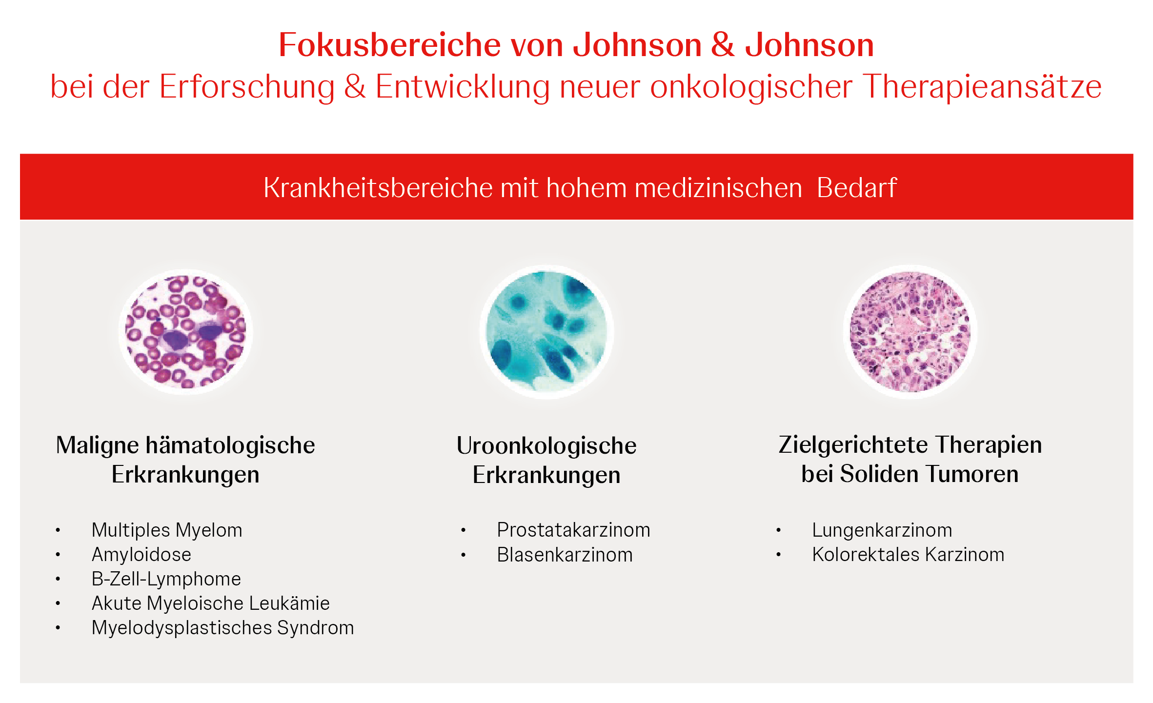 In der Entwicklung unserer onkologischen Arzneimittel setzen wir dabei auf die Präzisionsmedizin und fokussieren uns auch im Bereich Immunonkologie  vor allem auf präzise wirkende Immuntherapien.
