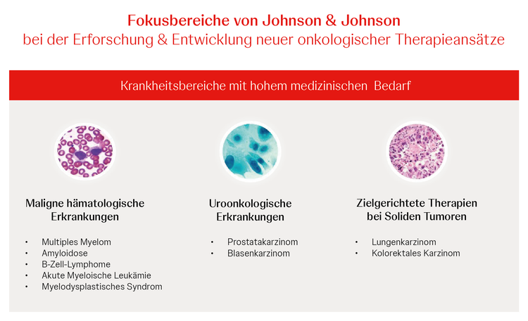 Fokusbereiche Janssen Krebsforschung In der Entwicklung unserer onkologischen Arzneimittel setzen wir dabei auf die Präzisionsmedizin und fokussieren uns auch im Bereich Immunonkologie vor allem auf präzise wirkende Immuntherapien.