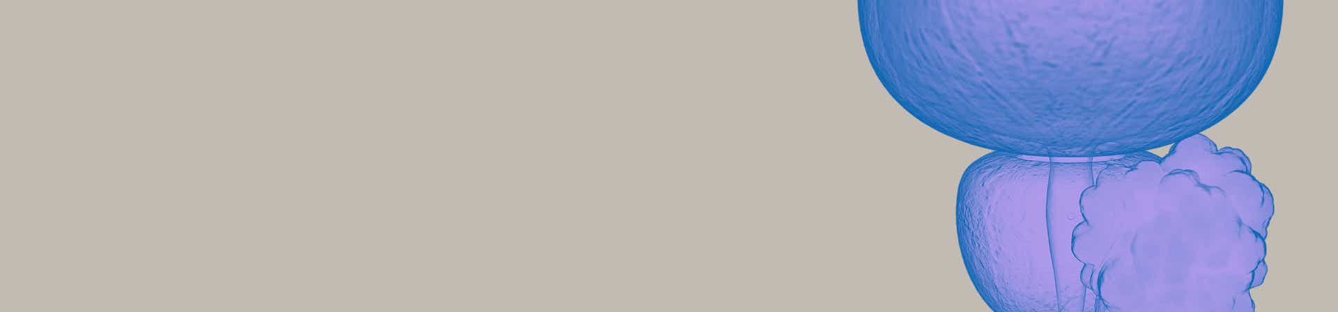 Prostatakarzinom (Prostatakrebs)