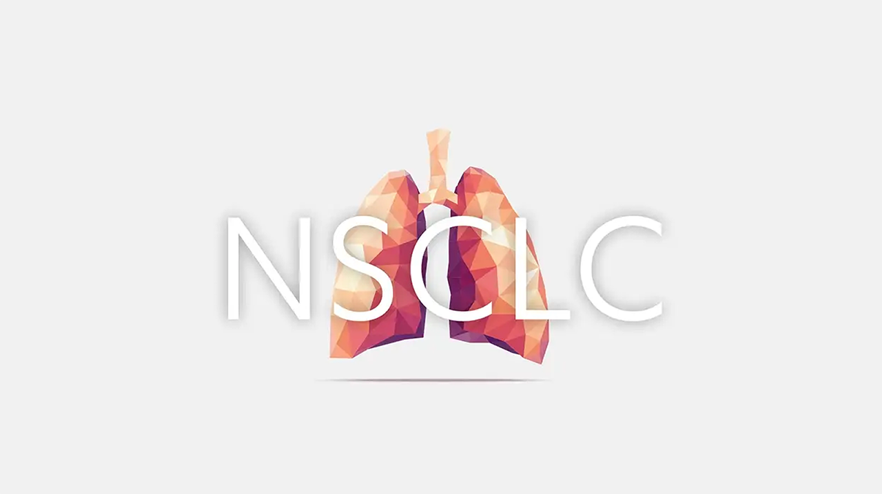 Bild einer Lunge mit Schriftzug NSCLC davor