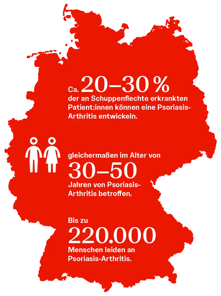 psoriasis-arthritis-in-zahlen-wer-bekommt-diese-erkrankung Karte Deutschlands mit Hinweis auf Anteil der an Schuppenflechte Erkrankter mit Psoriasis-Arthritis (20-30 %), Häufigkeit von Psoriasis-Arthritis (bis zu 220.000 Menschen) und Verteilung zwischen den Geschlechtern (Männer und Frauen gleich häufig betroffen im Alter von 30-50 Jahren)