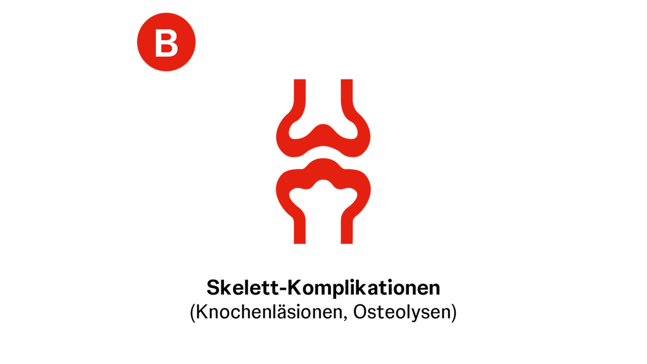Das vierte CRAB-Kriterium steht für B wie Bone lesions definiert als mindestens 1 Läsion in der Bildgebung