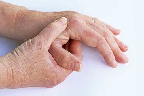 Schmerzhafte Gelenke bei Psoriasis-Arthritis