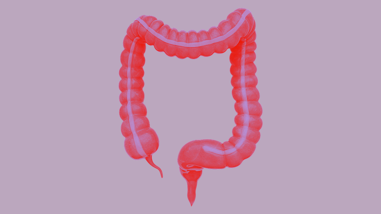 Stilisierte medizinische Illustration des menschlichen Dickdarms beginnend beim Blinddarm mit Wurmfortsatz über das aufsteigende Colon, das Quercolon, das absteigende Colon und das Colon sigmoideum hinweg bis zum Mastdarm und Rektum. Das Organ ist in leuchtendem Rot gehalten und hebt sich kontrastreich vom lila Hintergrund ab.