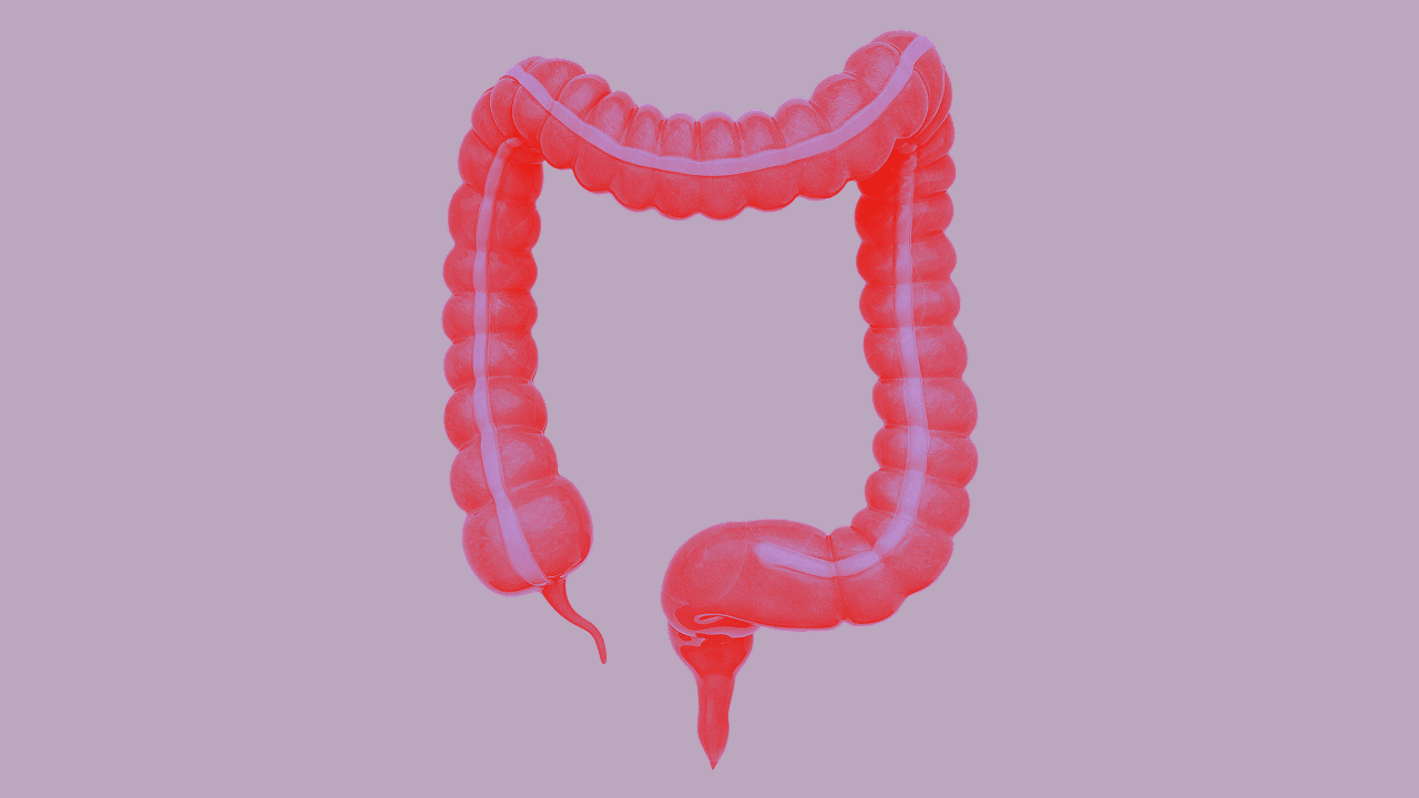 Stilisierte medizinische Illustration des menschlichen Dickdarms beginnend beim Blinddarm mit Wurmfortsatz über das aufsteigende Colon, das Quercolon, das absteigende Colon und das Colon sigmoideum hinweg bis zum Mastdarm und Rektum. Das Organ ist in leuchtendem Rot gehalten und hebt sich kontrastreich vom lila Hintergrund ab.