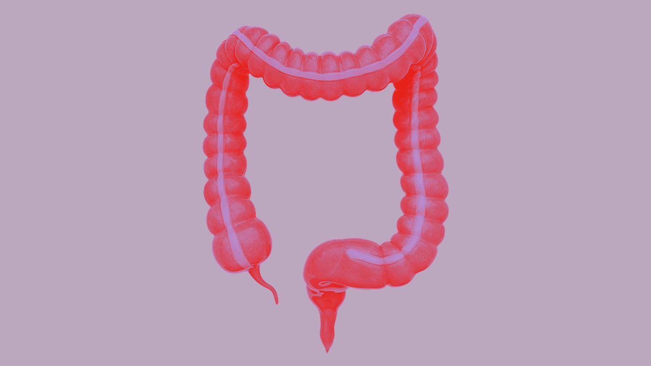 Stilisierte medizinische Illustration des menschlichen Dickdarms beginnend beim Blinddarm mit Wurmfortsatz über das aufsteigende Colon, das Quercolon, das absteigende Colon und das Colon sigmoideum hinweg bis zum Mastdarm und Rektum. Das Organ ist in leuchtendem Rot gehalten und hebt sich kontrastreich vom lila Hintergrund ab.