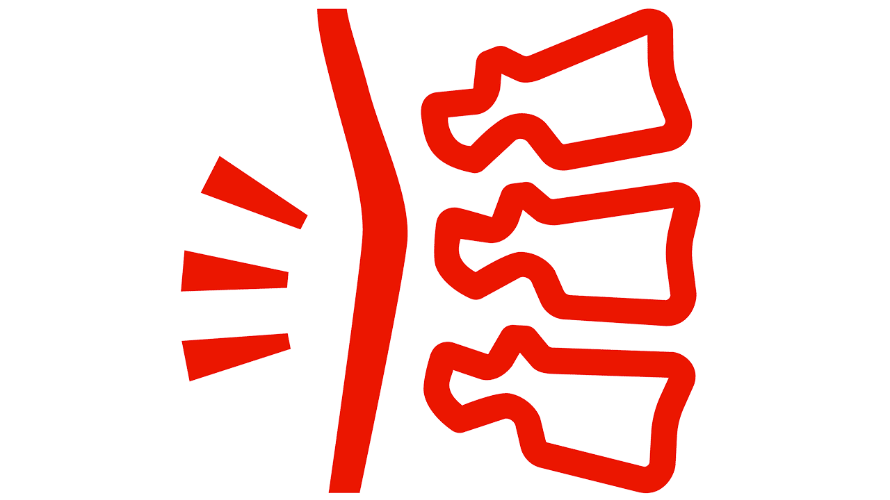 ruckenschmerzen Symbolische Darstellung einer schmerzenden Wirbelsäule als typisches Symptom einer Psoriasis-Arthritis