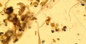 A diverse grouping of nematodes (longer, worm-like structures) along with a tardigrade and some small soil debris that made i