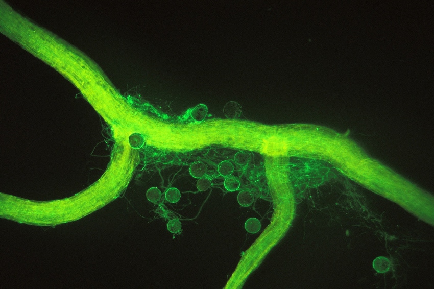 Microscopic image of arbuscular mycorrhizal fungi and glomalin