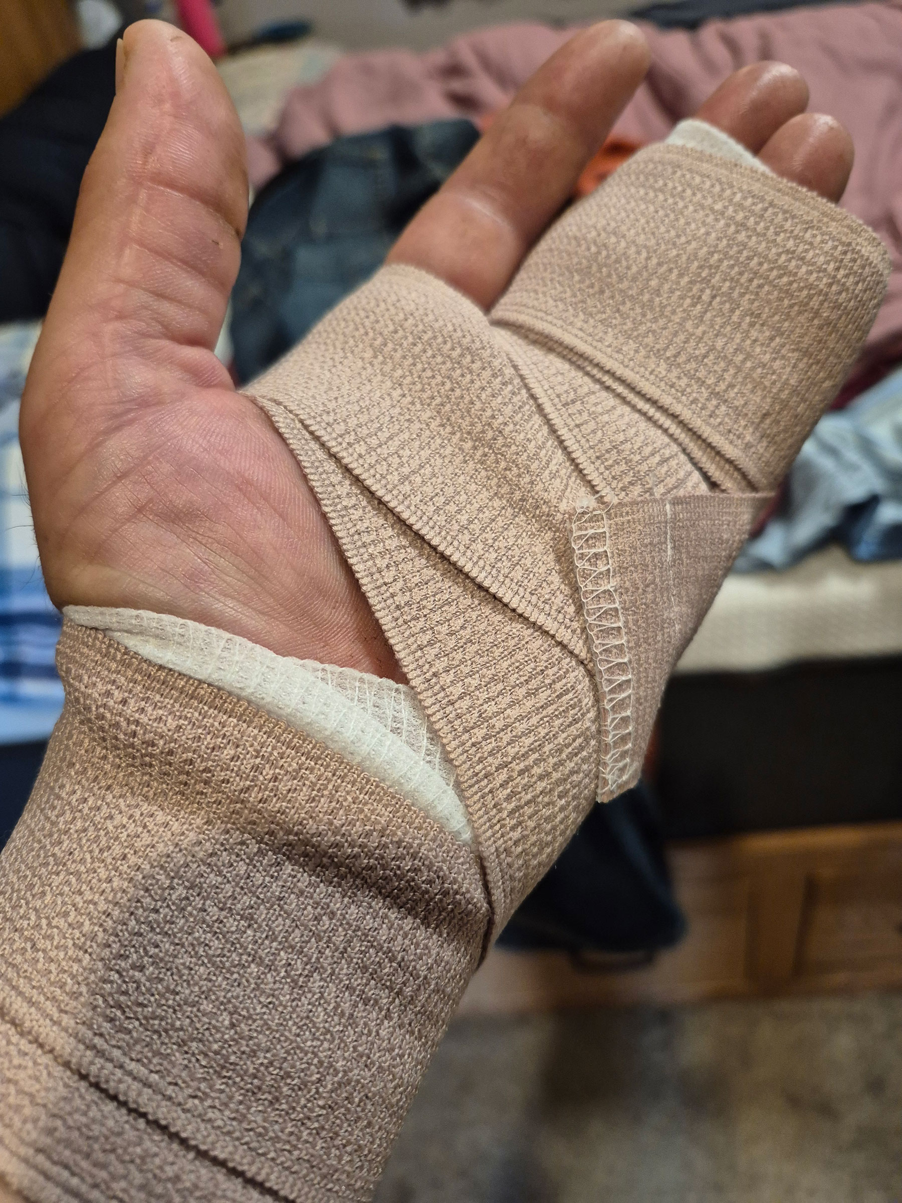 Farm machinery accident: Quick thinking saves farmer's hand