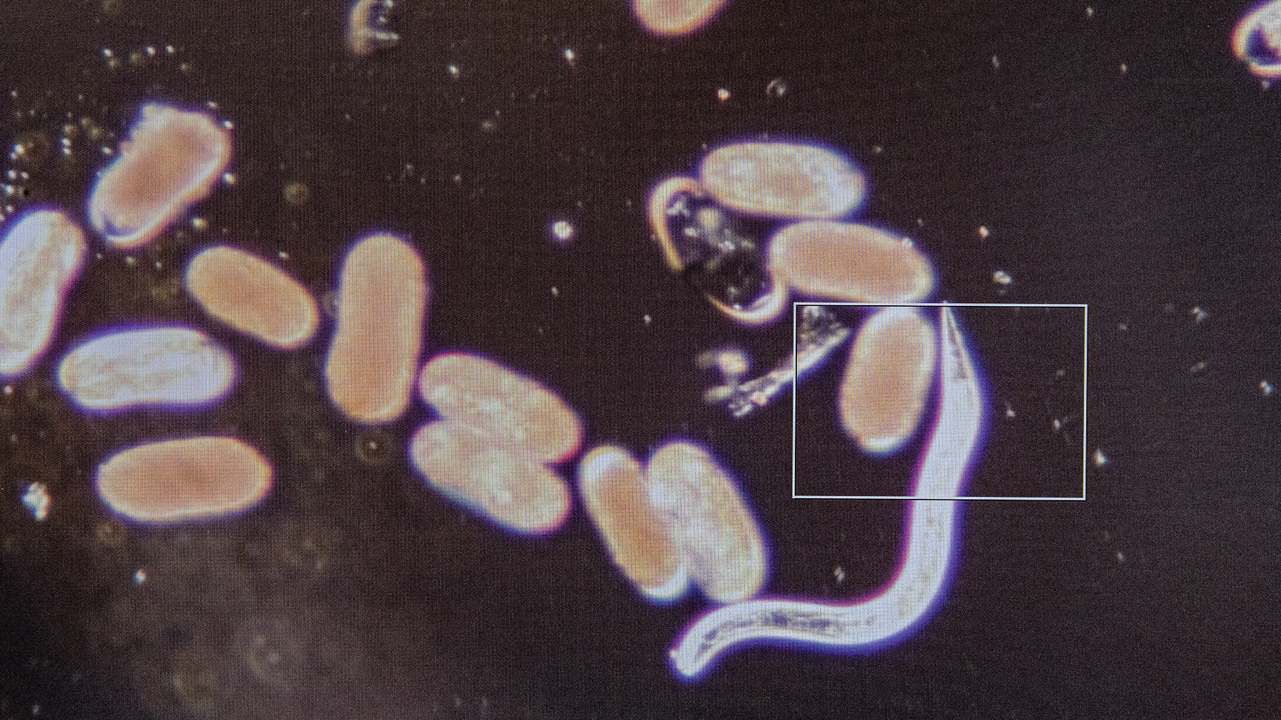Gil Gullickson - Soybean cyst nematode is invisible to the naked eye. Under the microscope, though, nematologists can see this soilborne worm at work amid a sea of SCN eggs