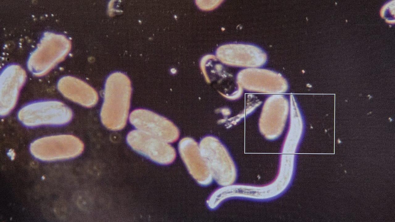 Gil Gullickson - Soybean cyst nematode is invisible to the naked eye. Under the microscope, though, nematologists can see this soilborne worm at work amid a sea of SCN eggs