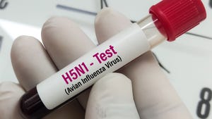 Blood Sample for H5N1, Avian Influenza virus