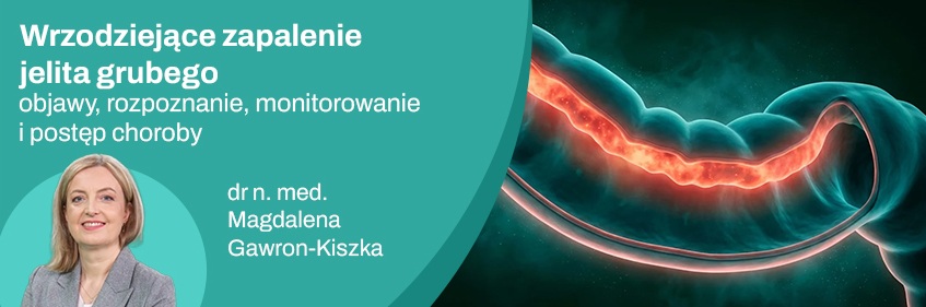 Wrzodziejące zapalenie jelita grubego – objawy, rozpoznanie, monitorowanie i postęp choroby 1z2