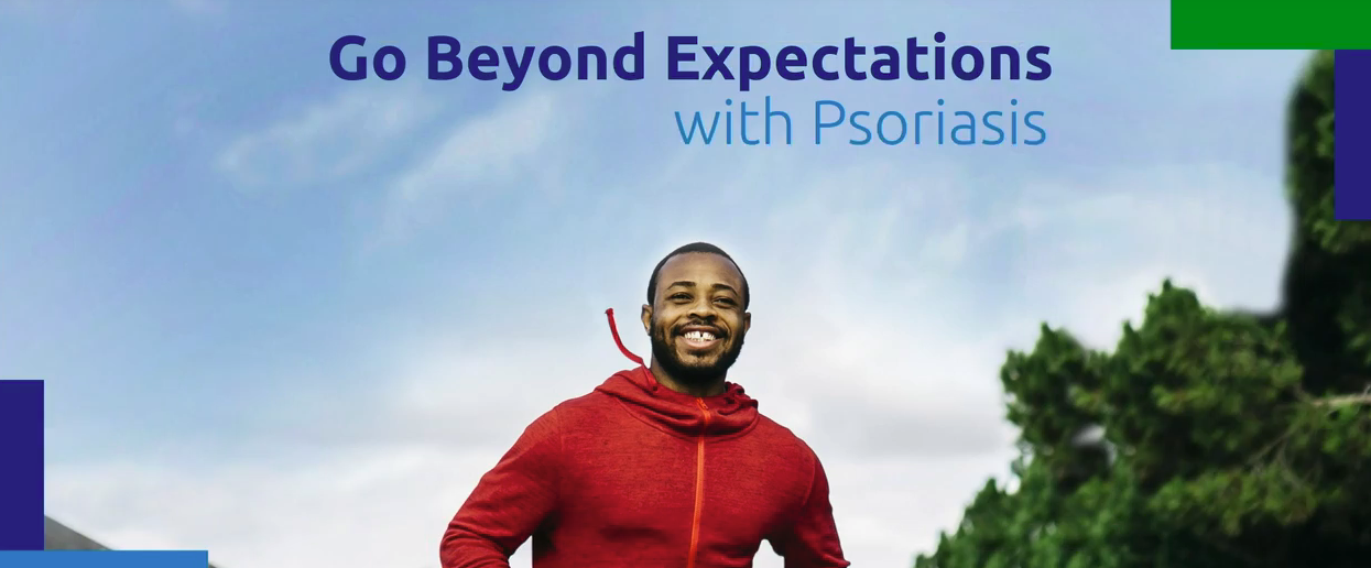 تجاوز التوقعات