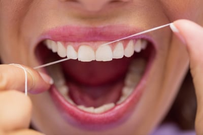 curatare-interdentara-ata-dentara-impotriva-cariilor