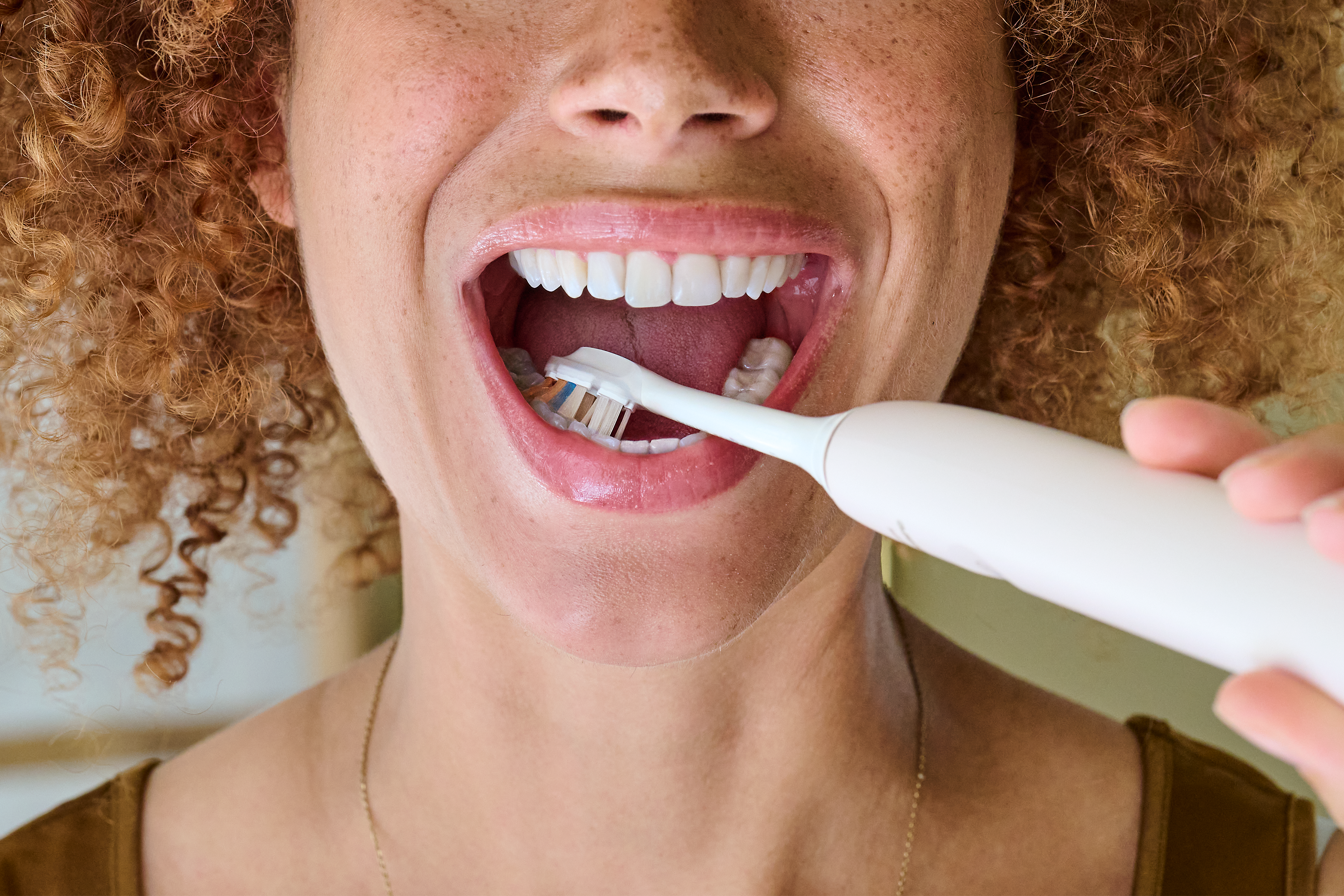 White tongue 101: Causes, fixes & prevention  