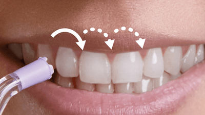 Patient using the power flosser