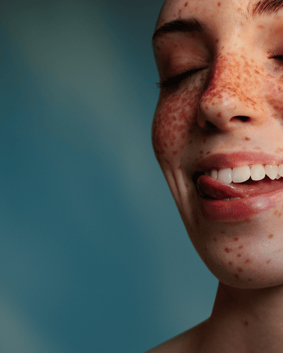 90 dní záruka vrátenia peňazí Sonicare