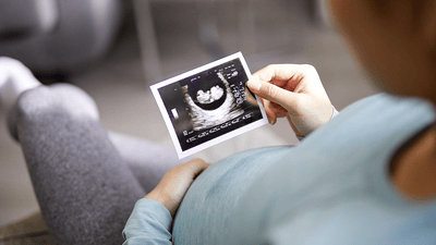 Mujer sosteniendo una foto de ultrasonido