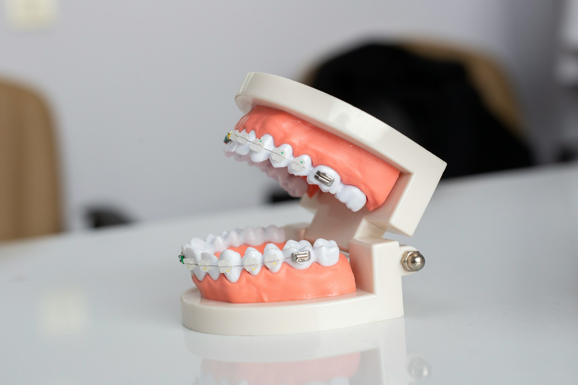 model-educational-dantura-cu-aparat-dentar-QT7ytJJwAnY.jpg