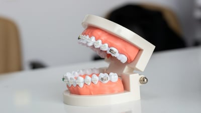 model-educational-dantura-cu-aparat-dentar-QT7ytJJwAnY.jpg