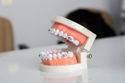 model-educational-dantura-cu-aparat-dentar-QT7ytJJwAnY.jpg