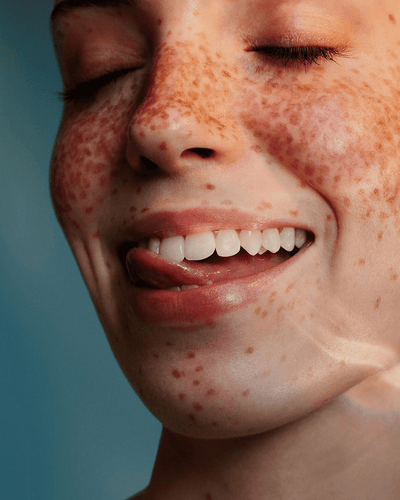 Sonicare pénzvisszafizetési garancia