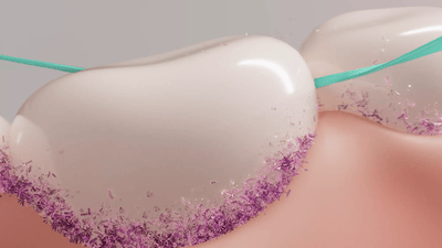 Image of power flosser