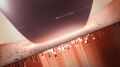 Prim-plan al flash-ului IPL