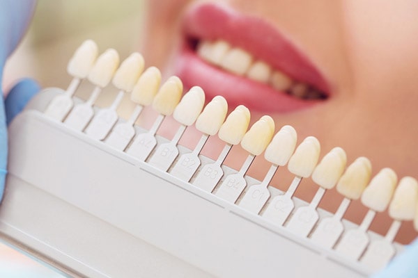 Вплив паління на колір зубів і як позбутися плям