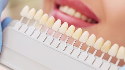 Як позбутися нальоту курця?