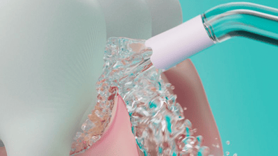 Image of power flosser
