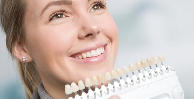 dental facets