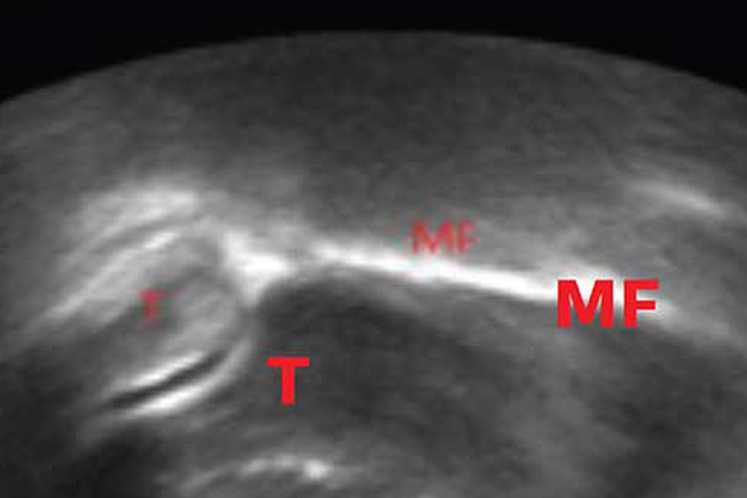 Image of MRI scan