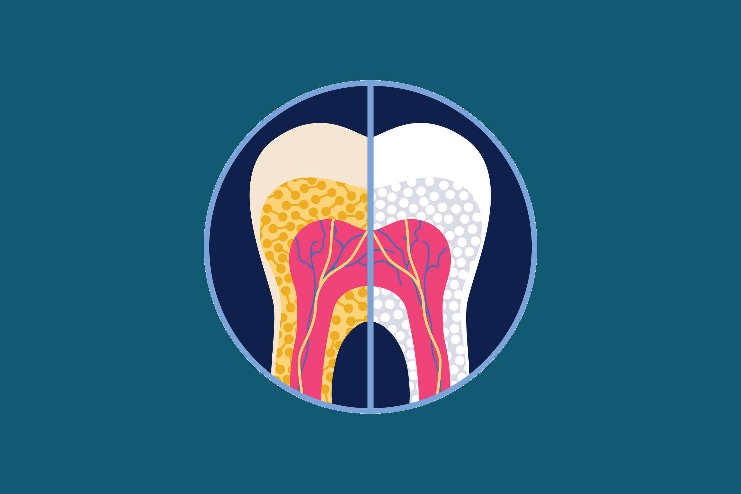 graphic of teeth whitening