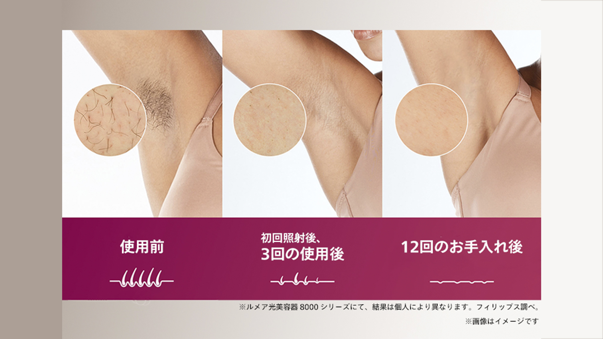 使い続けることで、太い毛も目立ちにくくなる※