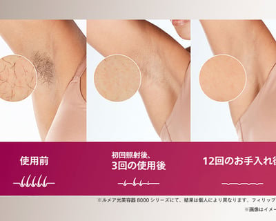 使い続けることで、太い毛も目立ちにくくなる※