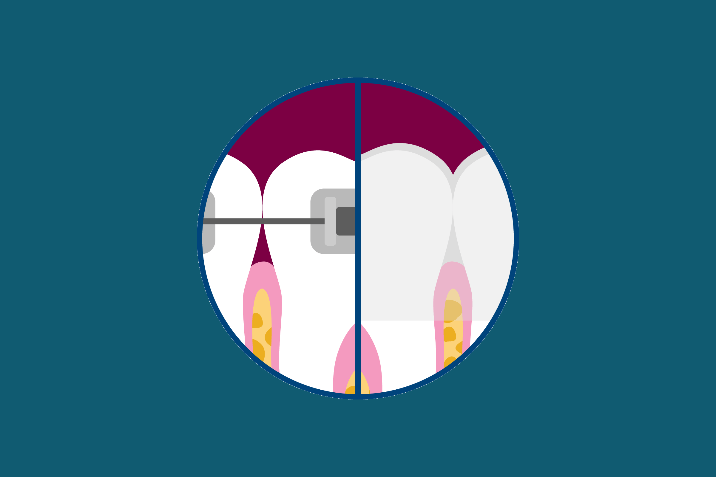 graphic of orthodontics