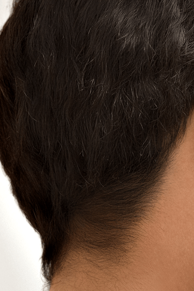 Degunam un citām zonām