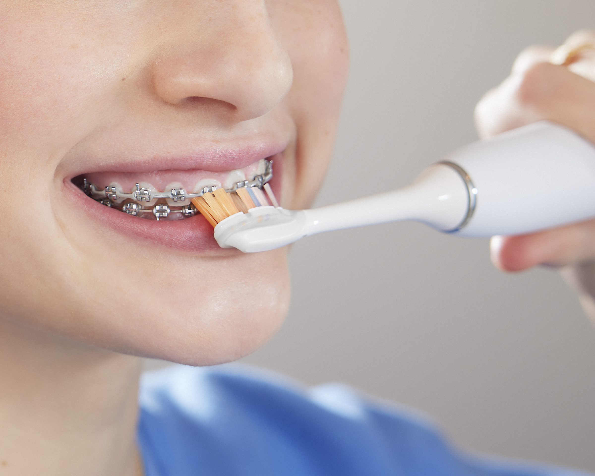 Patient with braces brushing bottom of front braces.