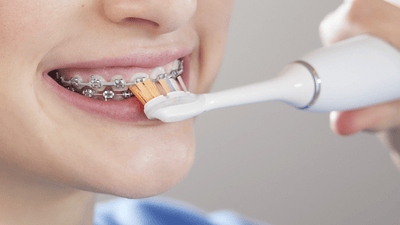 Patient with braces brushing bottom of front braces.