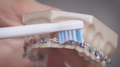 elektrický zubný kartáček