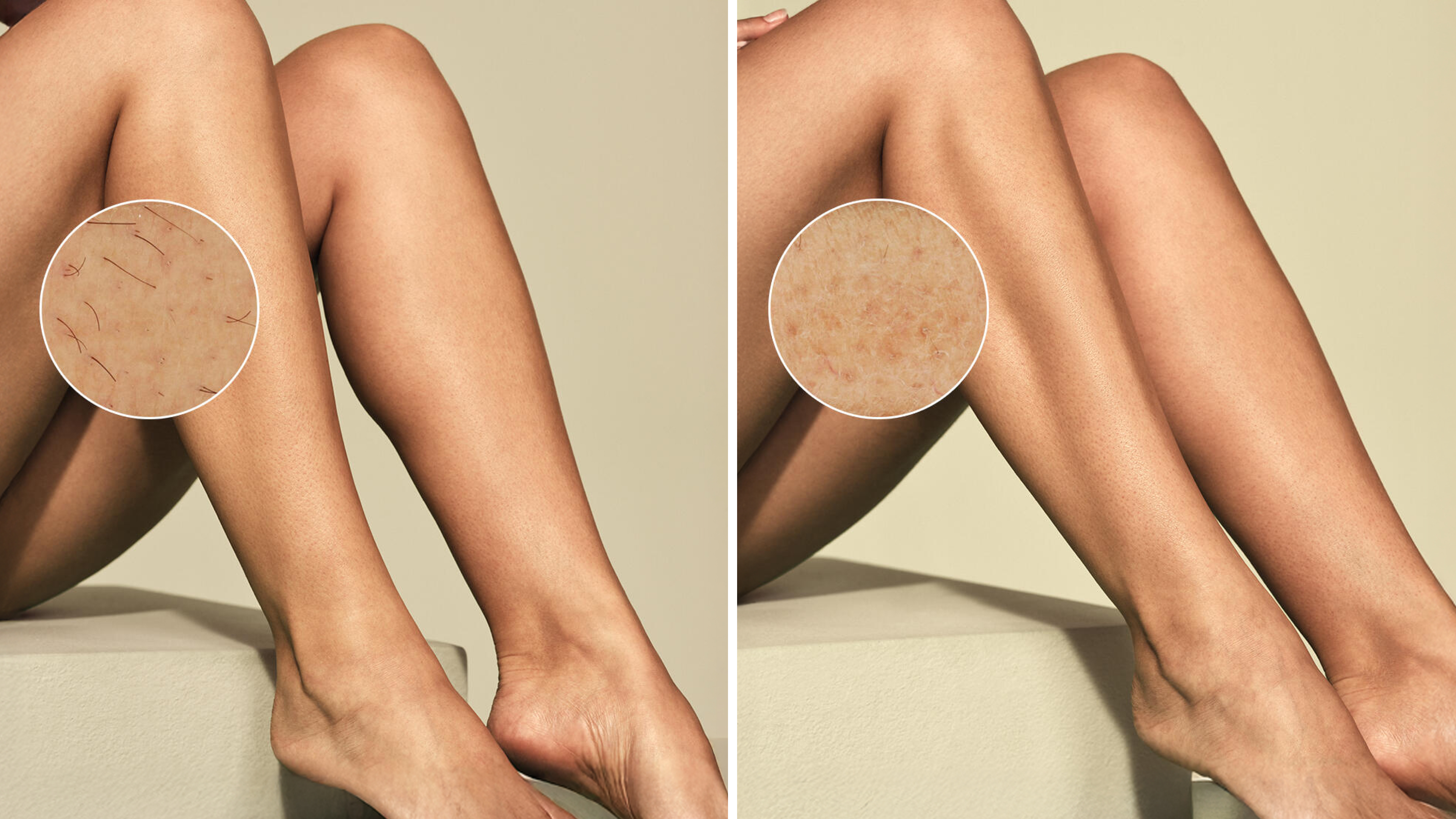 Крупний план ніг, що відпочивають на білих простирадлах