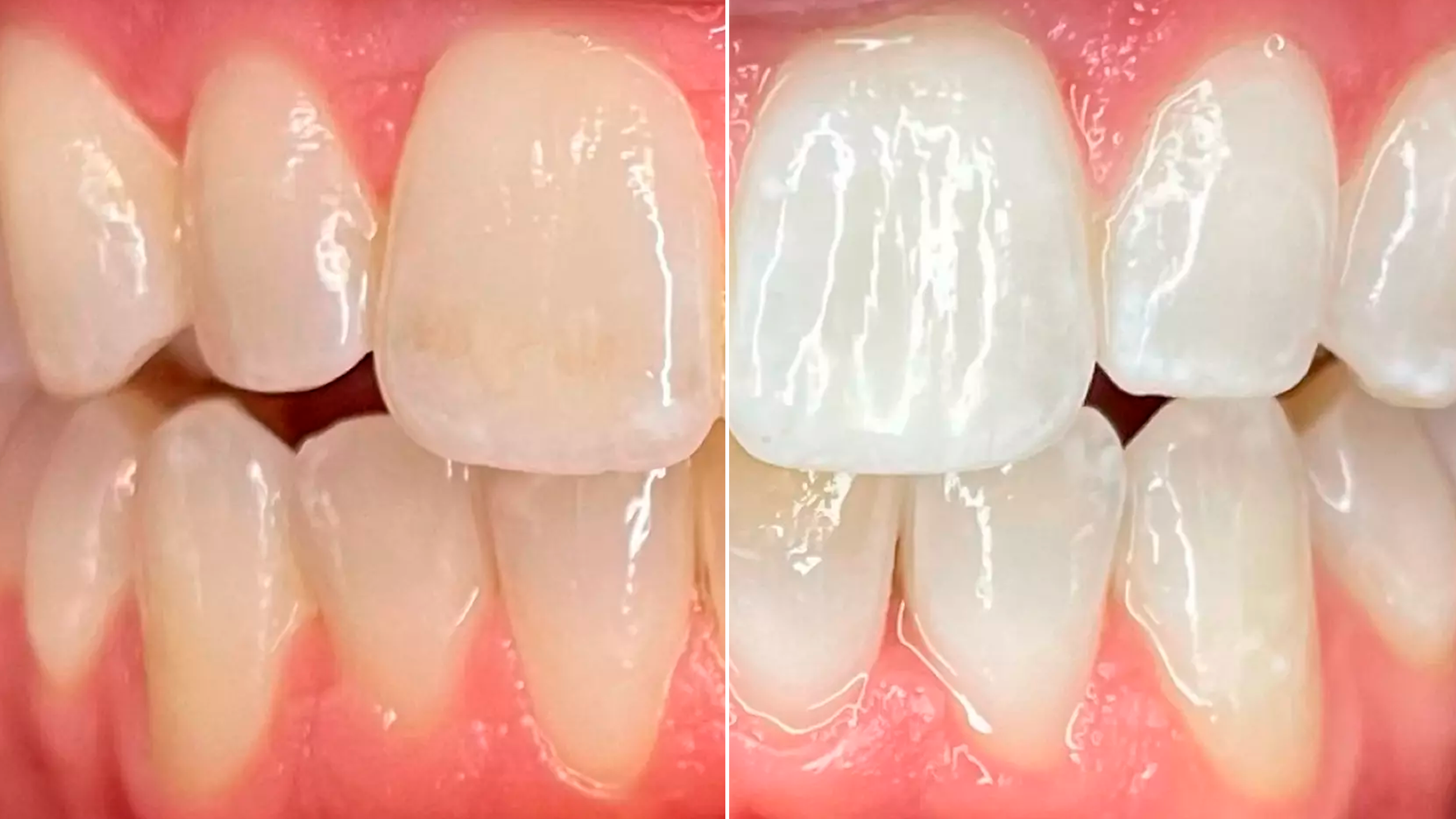 Noticeable shade improvements