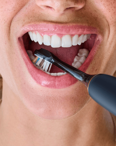 Sonicare kiterjesztett garancia