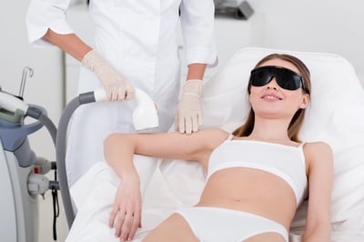 femeie-epilare-cu-laser-brat