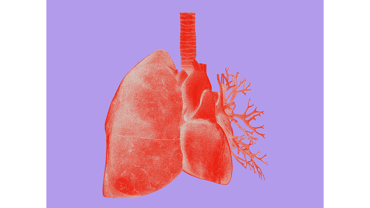 Stylised anatomical illustration of human lungs with bronchial tree A stylised anatomical illustration of the human lungs, showing the bronchial tree and trachea in red and coral tones against a lavender background. Serves as the visual identifier for the Lung Cancer condition card.